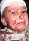 Terrorist Country USA bombing of Afghanistan wounded buy crying